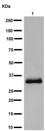 Western blot - Anti-SULT1A1/STP antibody [EPR15532] - N-terminal (AB191069)