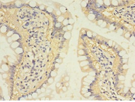 Immunohistochemistry (Formalin/PFA-fixed paraffin-embedded sections) - Anti-SULT1B1 antibody (AB235783)