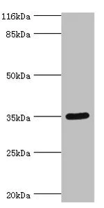 Western blot - Anti-SULT1B1 antibody (AB235783)