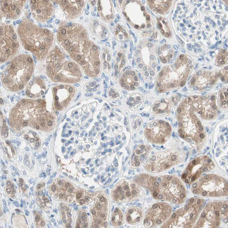 Immunohistochemistry (Formalin/PFA-fixed paraffin-embedded sections) - Anti-SULT1C2 antibody (AB243329)