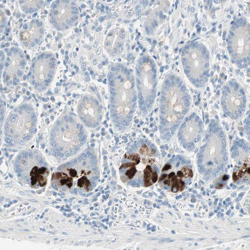 Immunohistochemistry (Formalin/PFA-fixed paraffin-embedded sections) - Anti-SULT1C2 antibody (AB243329)