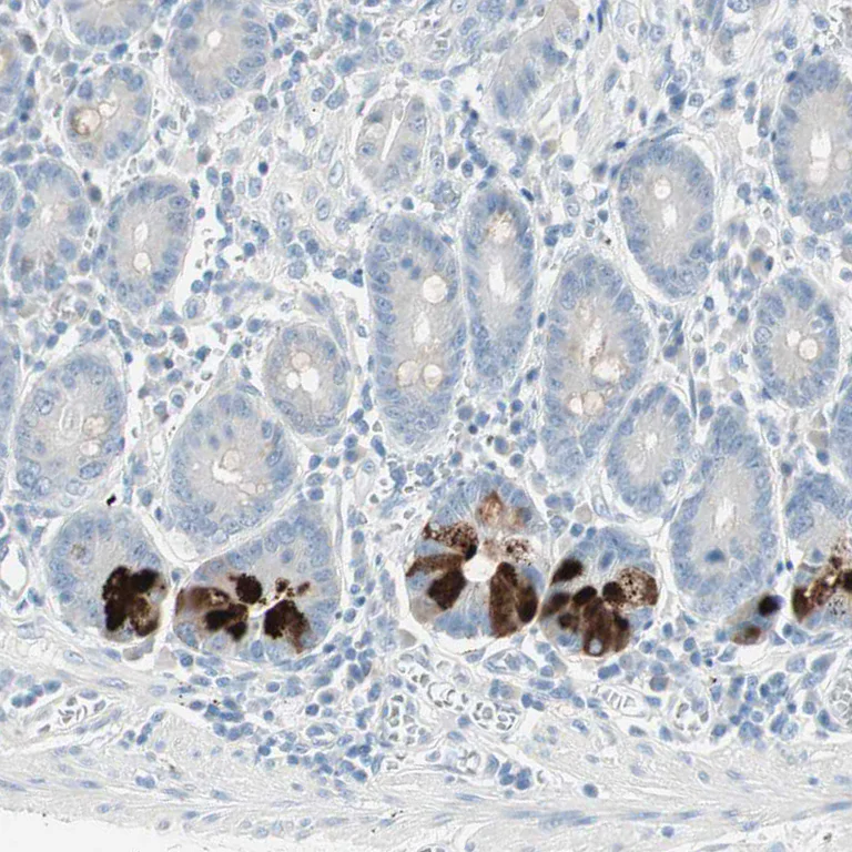 Immunohistochemistry (Formalin/PFA-fixed paraffin-embedded sections) - Anti-SULT1C2 antibody (AB243329)