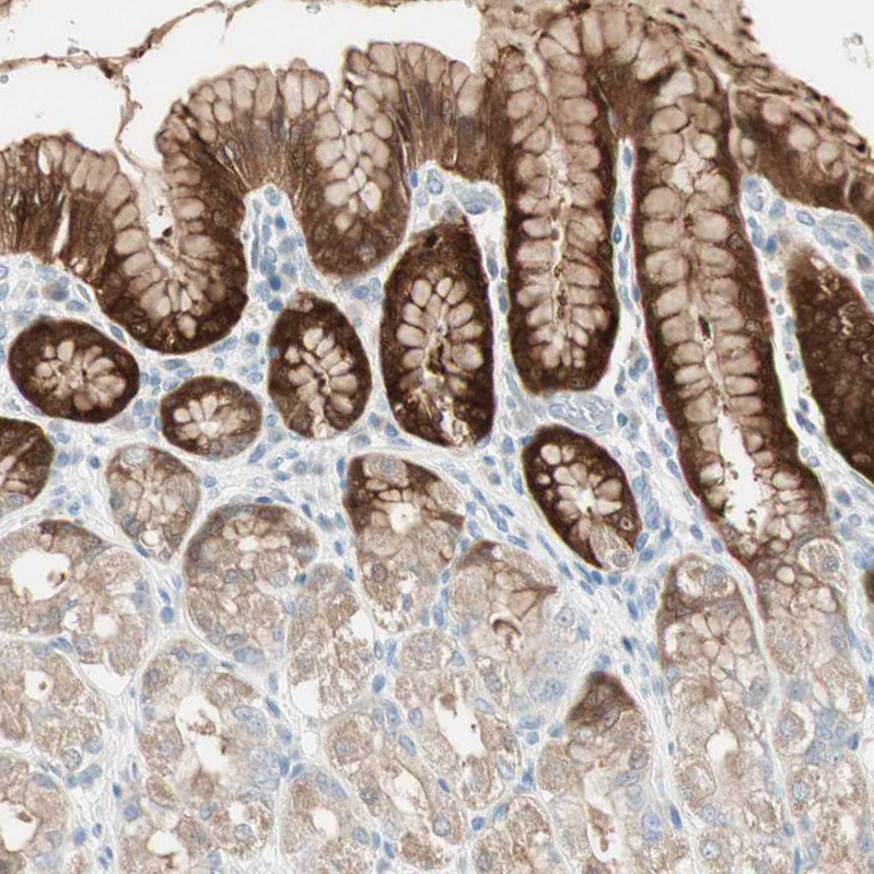Immunohistochemistry (Formalin/PFA-fixed paraffin-embedded sections) - Anti-SULT1C2 antibody (AB243329)