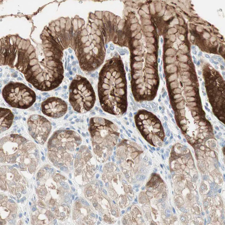 Immunohistochemistry (Formalin/PFA-fixed paraffin-embedded sections) - Anti-SULT1C2 antibody (AB243329)