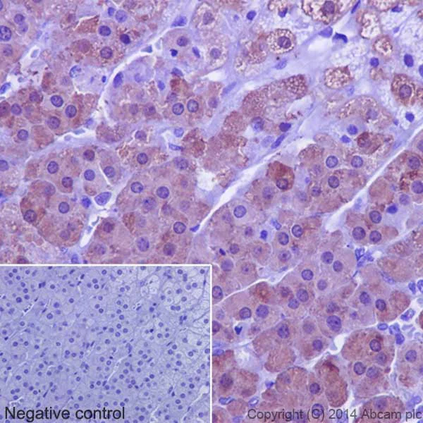 Immunohistochemistry (Formalin/PFA-fixed paraffin-embedded sections) - Anti-SULT2A1/ST2 antibody [EPR16096] (AB194113)
