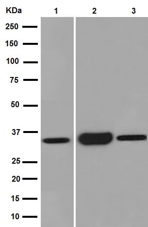 Western blot - Anti-SULT2A1/ST2 antibody [EPR16096] (AB194113), expandable thumbnail