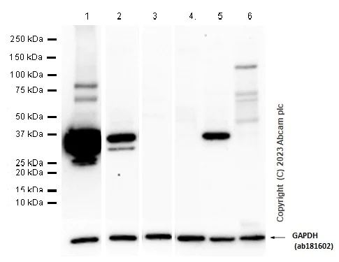 Western blot - Anti-SULT2A1/ST2 antibody [EPR16096] (AB194113)