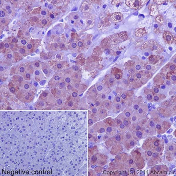 Immunohistochemistry (Formalin/PFA-fixed paraffin-embedded sections) - Anti-SULT2A1/ST2 antibody [EPR16096] - BSA and Azide free (AB240333), expandable thumbnail