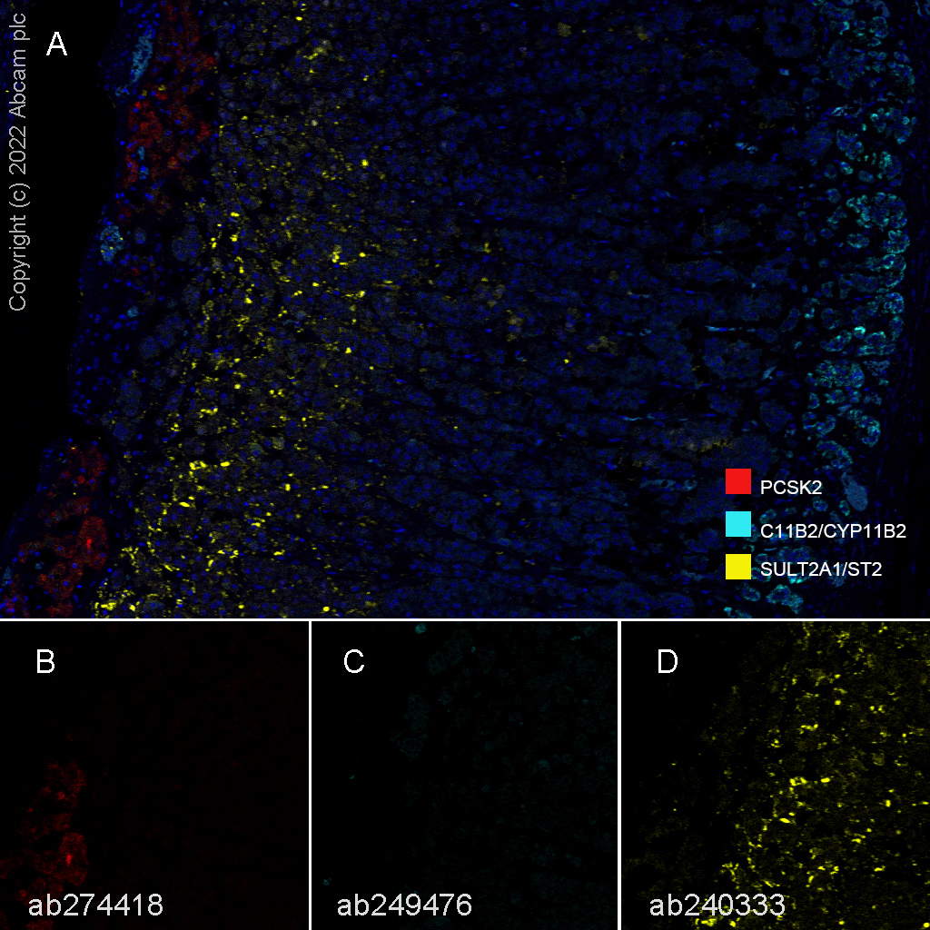 Multiplex immunohistochemistry - Anti-SULT2A1/ST2 antibody [EPR16096] - BSA and Azide free (AB240333), expandable thumbnail