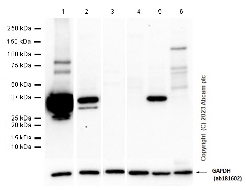 Western blot - Anti-SULT2A1/ST2 antibody [EPR16096] - BSA and Azide free (AB240333), expandable thumbnail