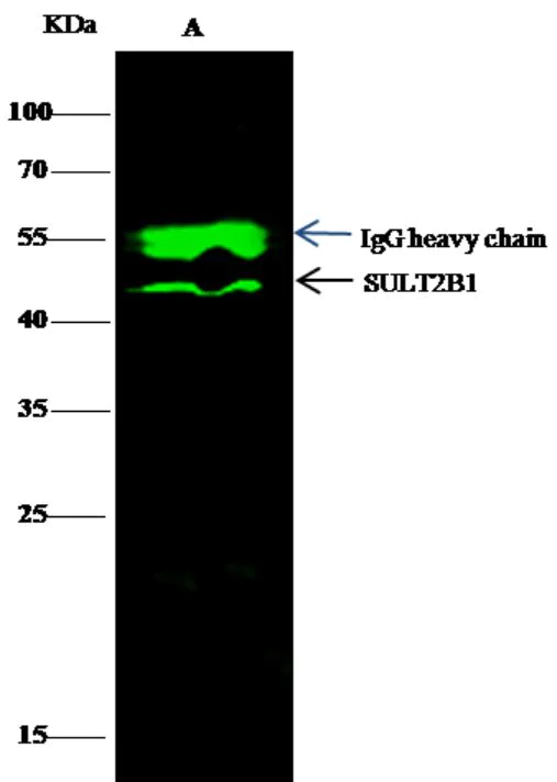 Immunoprecipitation - Anti-SULT2B1 antibody [007] - BSA and Azide free (AB276055)