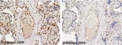 Immunohistochemistry (Formalin/PFA-fixed paraffin-embedded sections) - Anti-Sumo 1 antibody (AB11672), expandable thumbnail