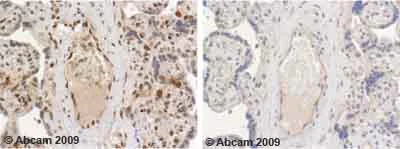 Immunohistochemistry (Formalin/PFA-fixed paraffin-embedded sections) - Anti-Sumo 1 antibody (AB11672)
