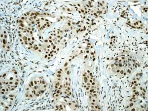 Immunohistochemistry (Formalin/PFA-fixed paraffin-embedded sections) - Anti-Sumo 1 antibody [EP298] (ab133352), expandable thumbnail