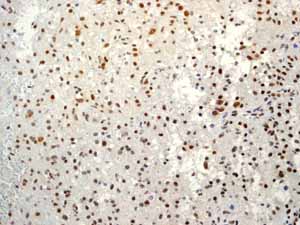 Immunohistochemistry (Formalin/PFA-fixed paraffin-embedded sections) - Anti-Sumo 1 antibody [EP298] (ab133352), expandable thumbnail