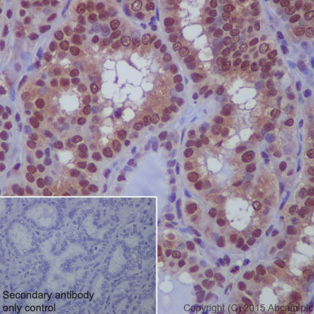 Immunohistochemistry (Formalin/PFA-fixed paraffin-embedded sections) - Anti-Sumo 1 antibody [EP298] (AB133352), expandable thumbnail