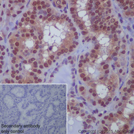 Immunohistochemistry (Formalin/PFA-fixed paraffin-embedded sections) - Anti-Sumo 1 antibody [EP298] (AB133352)