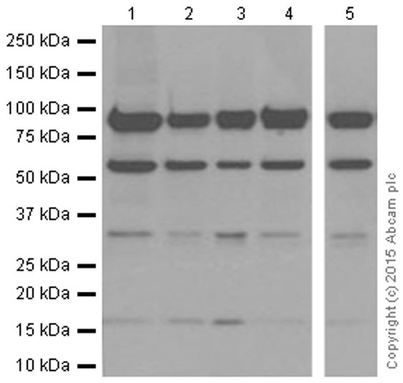 Western blot - Anti-Sumo 1 antibody [EP298] (AB133352), expandable thumbnail