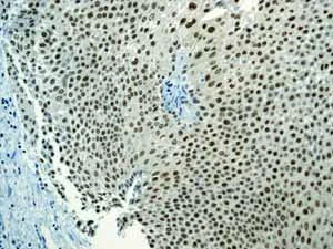 Immunohistochemistry (Formalin/PFA-fixed paraffin-embedded sections) - Anti-Sumo 1 antibody [EP298] - BSA and Azide free (AB248491)