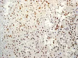 Immunohistochemistry (Formalin/PFA-fixed paraffin-embedded sections) - Anti-Sumo 1 antibody [EP298] - BSA and Azide free (AB248491)