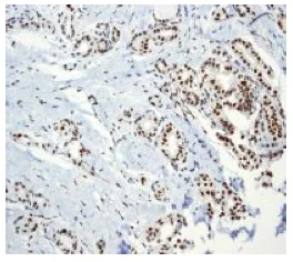 Immunohistochemistry (Formalin/PFA-fixed paraffin-embedded sections) - Anti-Sumo 1 antibody [EP298] - BSA and Azide free (AB248491)
