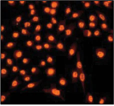 Immunocytochemistry/ Immunofluorescence - Anti-Sumo 1 antibody [Y299] - BSA and Azide free (AB219724)