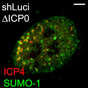 Immunocytochemistry/ Immunofluorescence - Anti-Sumo 1 antibody [Y299] - ChIP Grade (AB32058)