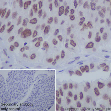 Immunohistochemistry (Formalin/PFA-fixed paraffin-embedded sections) - Anti-Sumo 1 antibody [Y299] - ChIP Grade (AB32058)