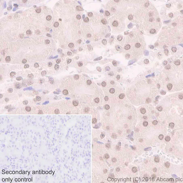 Immunohistochemistry (Formalin/PFA-fixed paraffin-embedded sections) - Anti-Sumo 1 antibody [Y299] - ChIP Grade (AB32058)