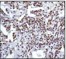 Immunohistochemistry (Formalin/PFA-fixed paraffin-embedded sections) - Anti-Sumo 1 antibody [Y299] - ChIP Grade (AB32058)