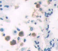 Immunohistochemistry (Formalin/PFA-fixed paraffin-embedded sections) - Anti-Sumo 2 antibody (AB233222)