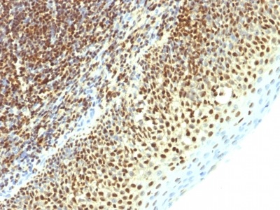 Immunohistochemistry (Formalin/PFA-fixed paraffin-embedded sections) - Anti-Sumo 2 antibody [SPM621] - BSA and Azide free (AB212838)