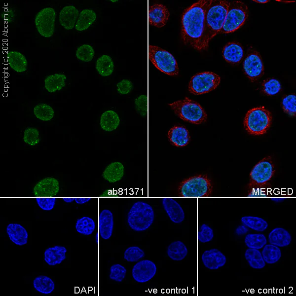 Immunocytochemistry/ Immunofluorescence - Anti-Sumo 2 + Sumo 3 antibody [8A2] (AB81371)