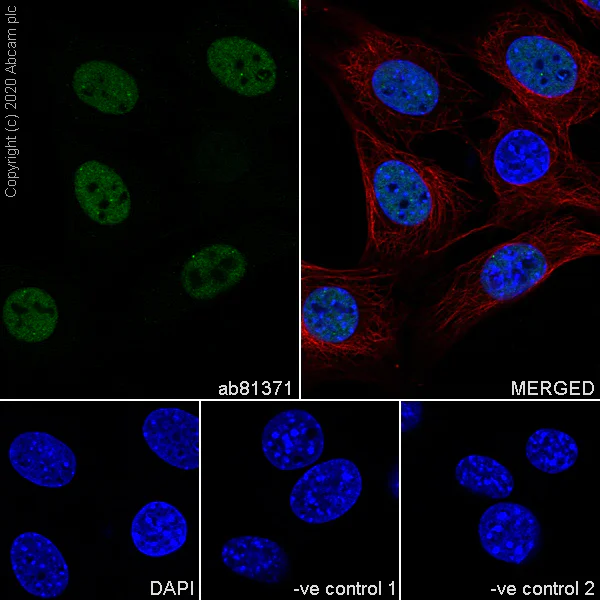 Immunocytochemistry/ Immunofluorescence - Anti-Sumo 2 + Sumo 3 antibody [8A2] (AB81371)