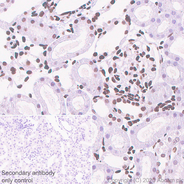 Immunohistochemistry (Formalin/PFA-fixed paraffin-embedded sections) - Anti-Sumo 2 + Sumo 3 antibody [8A2] (AB81371)