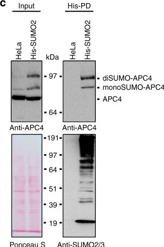 Western blot - Anti-Sumo 2 + Sumo 3 antibody [8A2] (AB81371)