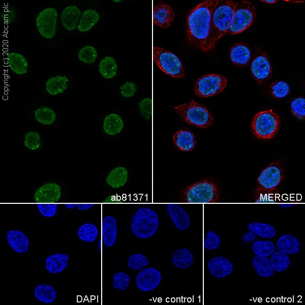 Immunocytochemistry - Anti-Sumo 2 + Sumo 3 antibody [8A2] - BSA and Azide free (ab252805), expandable thumbnail