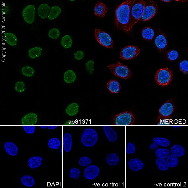 Immunocytochemistry - Anti-Sumo 2 + Sumo 3 antibody [8A2] - BSA and Azide free (AB252805)
