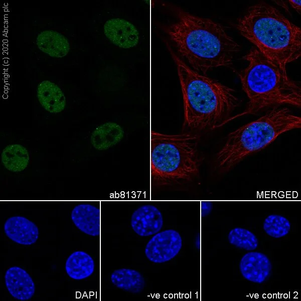Immunocytochemistry - Anti-Sumo 2 + Sumo 3 antibody [8A2] - BSA and Azide free (AB252805)