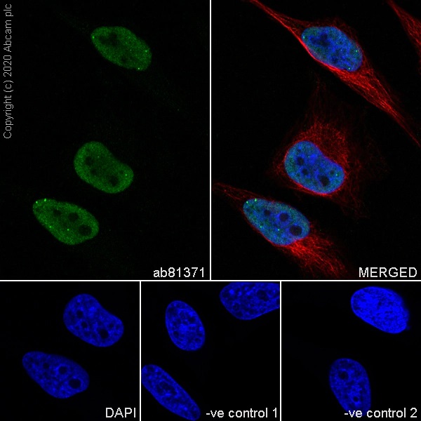 Immunocytochemistry - Anti-Sumo 2 + Sumo 3 antibody [8A2] - BSA and Azide free (AB252805), expandable thumbnail