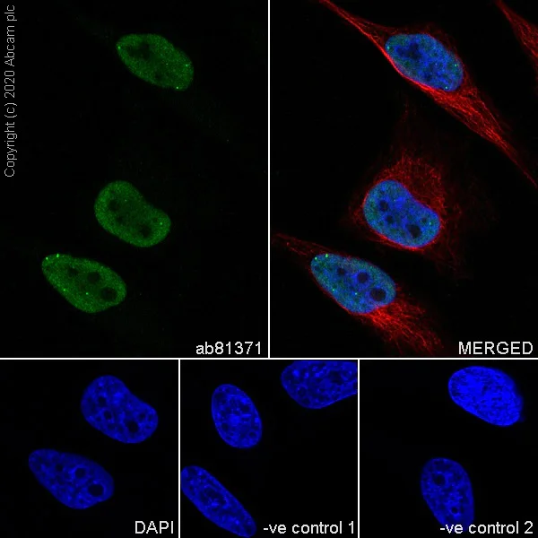Immunocytochemistry - Anti-Sumo 2 + Sumo 3 antibody [8A2] - BSA and Azide free (AB252805)