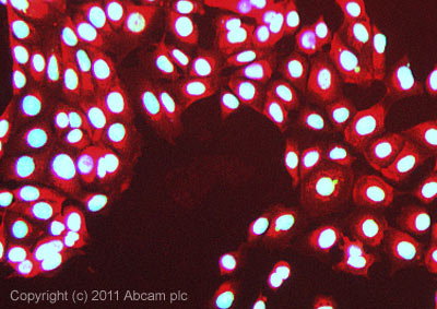 Immunocytochemistry/ Immunofluorescence - Anti-Sumo 2 + Sumo 3 antibody (AB22654)