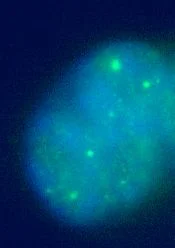 Immunocytochemistry/ Immunofluorescence - Anti-Sumo 2 + Sumo 3 antibody (AB3742)