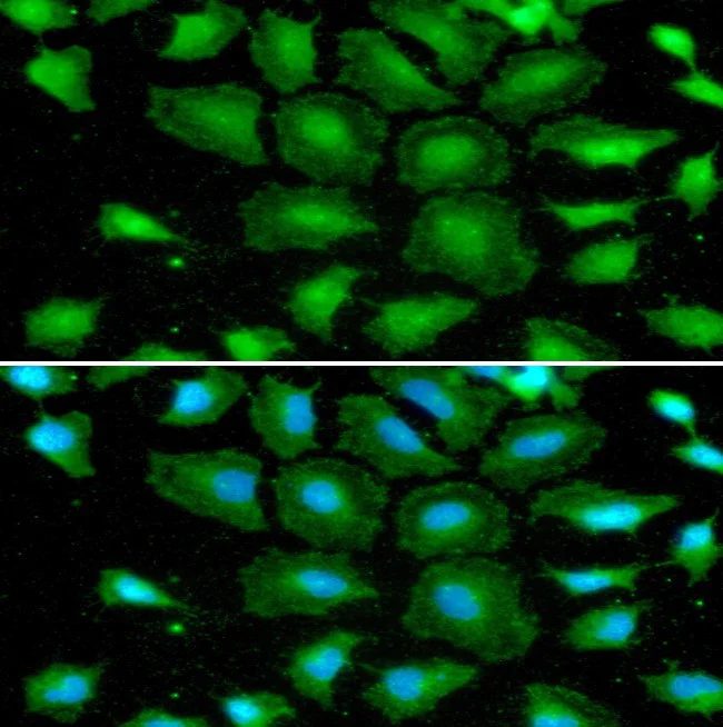 Immunocytochemistry/ Immunofluorescence - Anti-Sumo 2 + Sumo 3 antibody [AT10F1] (AB282157)
