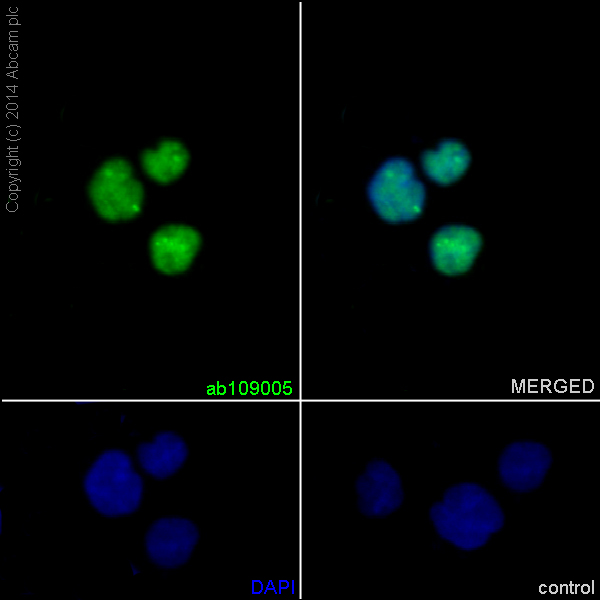 Immunocytochemistry/ Immunofluorescence - Anti-Sumo 2 + Sumo 3 antibody [EPR4602] (AB109005), expandable thumbnail