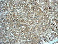 Immunohistochemistry (Formalin/PFA-fixed paraffin-embedded sections) - Anti-Sumo 2 + Sumo 3 antibody [EPR4602] (AB109005), expandable thumbnail