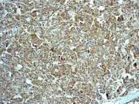 Immunohistochemistry (Formalin/PFA-fixed paraffin-embedded sections) - Anti-Sumo 2 + Sumo 3 antibody [EPR4602] (AB109005)