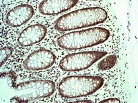 Immunohistochemistry (Formalin/PFA-fixed paraffin-embedded sections) - Anti-Sumo 2 + Sumo 3 antibody [EPR4602] (AB109005), expandable thumbnail