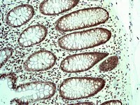 Immunohistochemistry (Formalin/PFA-fixed paraffin-embedded sections) - Anti-Sumo 2 + Sumo 3 antibody [EPR4602] (AB109005)