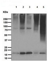 Western blot - Anti-Sumo 2 + Sumo 3 antibody [EPR4602] (AB109005), expandable thumbnail